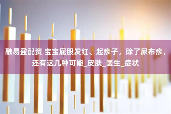 融易盈配资 宝宝屁股发红、起疹子，除了尿布疹，还有这几种可能_皮肤_医生_症状